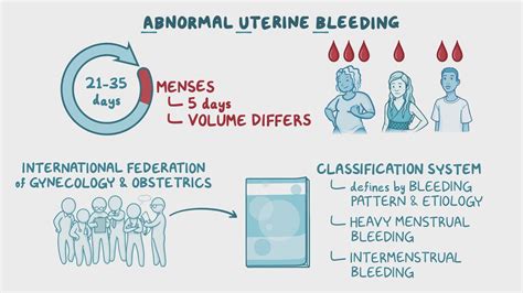 Approach To Abnormal Uterine Bleeding In Reproductive Aged Patients