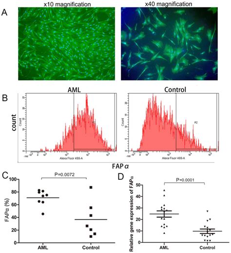 Expression and role of fibroblast activation protein α in acute myeloid