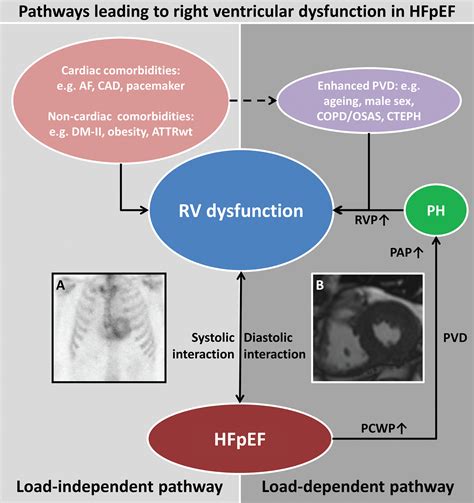 Right Heart Dysfunction And Failure In Heart Failure With Preserved