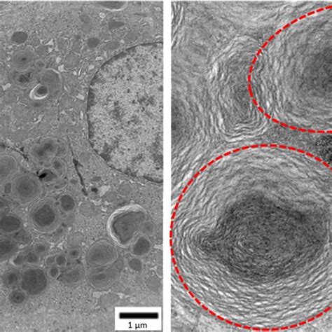 Liver Centrilobular Hepatocyte Showing Lamellar Bodies Liver Left Download Scientific