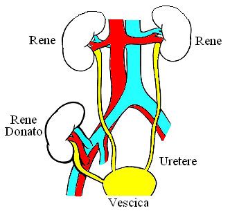 Clipart Di Trapianto Di Rene