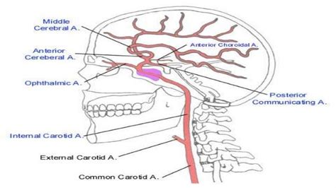 Segments Of Internal Carotid Artery