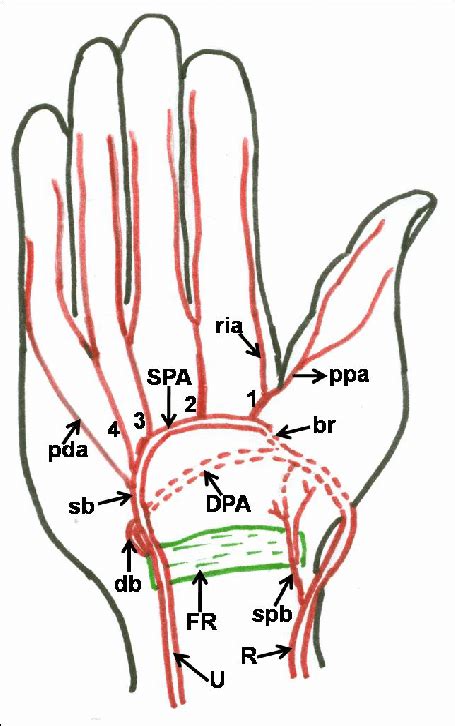 Palmar Arch Study