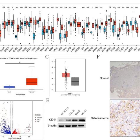 Expression Of Cd44 In Sarcoma And Osteosarcoma A Cd44 Expression In Download Scientific