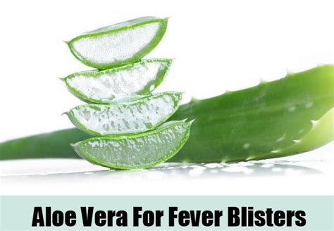 5 Home Remedies For Fever Blisters Natural Home Remedies And Supplements