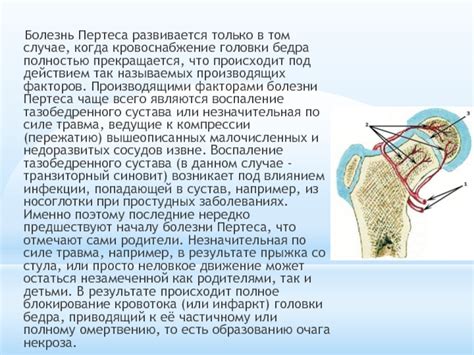 Болезнь Пертеса у детей
