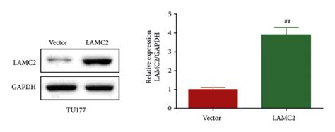 Lamc2 Was Highly Expressed In Lscc Cells A And B Lamc2 Mrna And Download Scientific