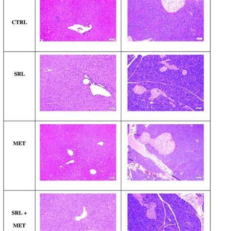 Representative Histology Of The Liver And Pancreas In Mice Untreated