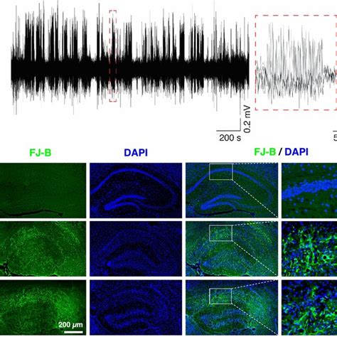 FIGURE Enhanced MPFC BLA Phase Synchrony In The Theta Range Before