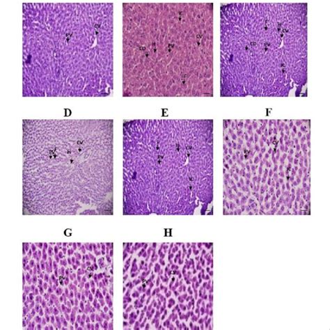 Representative Photomicrographs Of Liver Histopathology Liver Sections