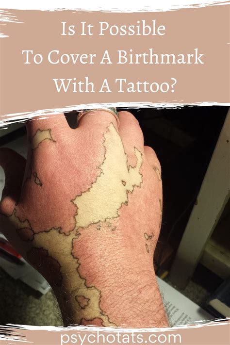 Covering Birthmarks With Tattoos What You Need To Know Elbow Tattoos