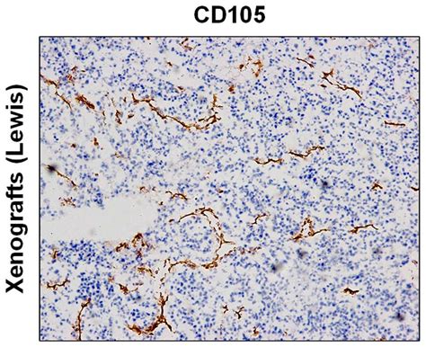 A Novel Method For Endothelial Cell Isolation