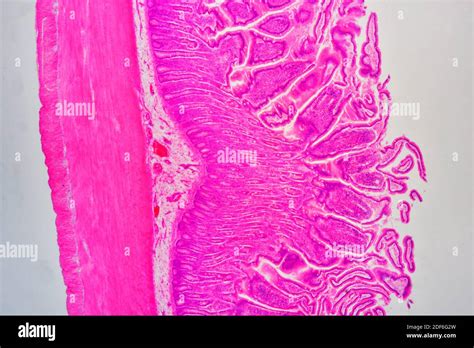 Lamina Propria Hi Res Stock Photography And Images Alamy