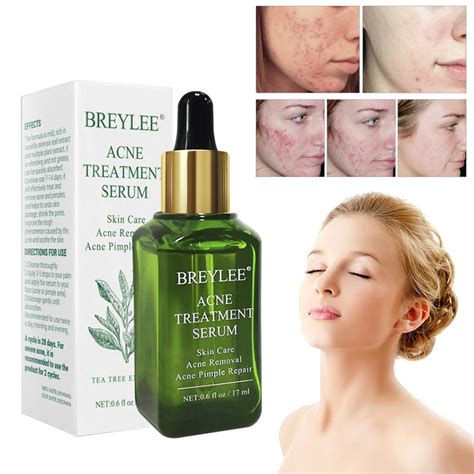 Breylee Acne Treatment Serum Facial Anti Acne Scar Removal Cream