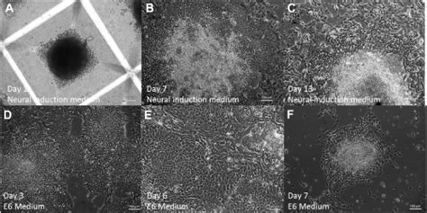 The Formation Of Neural Rosettes From Human Induced Pluripotent Stem Download Scientific