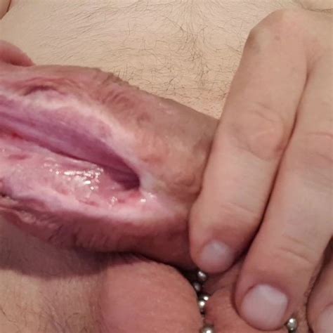 My Subincision Free HD Videos HD Porn Video 1f XHamster XHamster