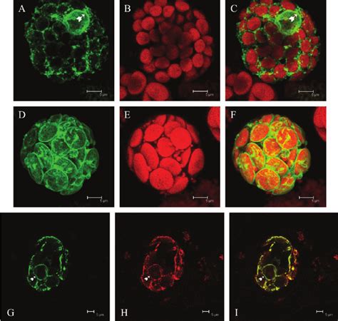 B 5 Nglyc And B 5 RRNglyc Have A Different Intracellular Localization