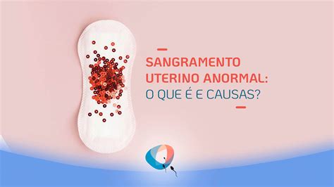 Sangramento Uterino Anormal O Que E Causas Dr Augusto Bussab