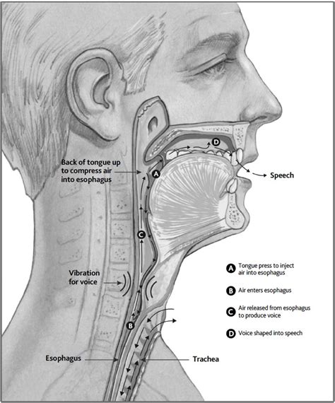 Esophageal Speech Lauder The Electrolarynx Company