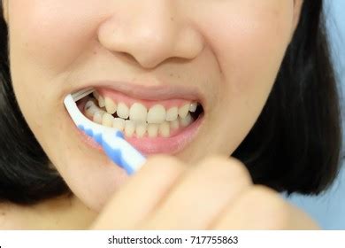 Doctor Putting Clear Dental Aligner Patient Stock Photo 1598735731