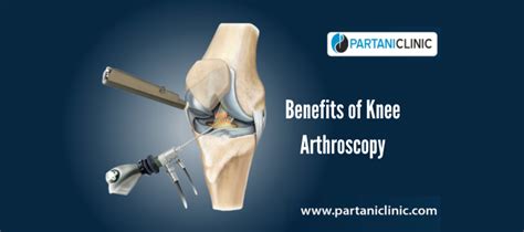 Benefits Of Knee Arthroscopy Partani Clinic Jaipur