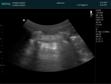 Pocus Academy Point Of Care Ultrasound Is The Visual Stethoscope In The 21st Century