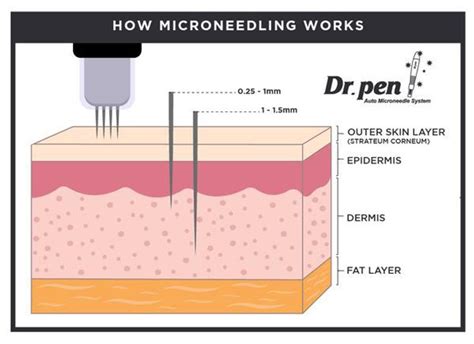 Microneedling Depth Chart