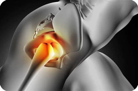 Hip Replacement Solutions | Shalby Advanced Technologies