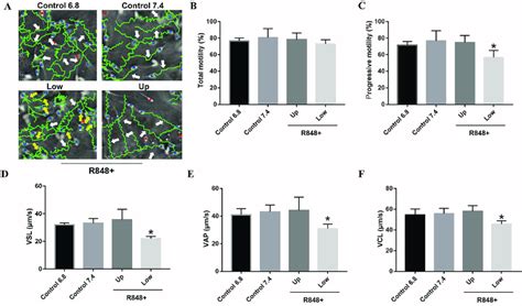 Computer Aided Sperm Analysis Casa Of Sperm Motility Indices A