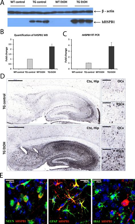 Transgene Expression Analysis In The Brain A HHSPB1 Protein Expression