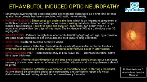 Ethambutol Induced Optic Neuropathy - EyeToday