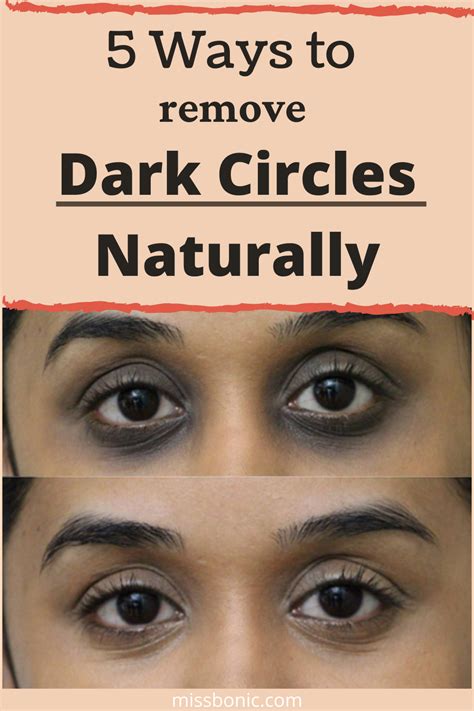 Say Goodbye To Under Eye Darkness Expert Tips To Beat Dark Circles By Dr A D Naseem Jan