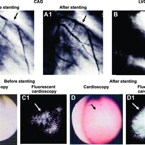 Cardioscope and cardioscopy procedure. (A) Cardioscope. a: guiding ...