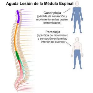 Tratamiento del paciente con lesion medular Guía de la discapacidad