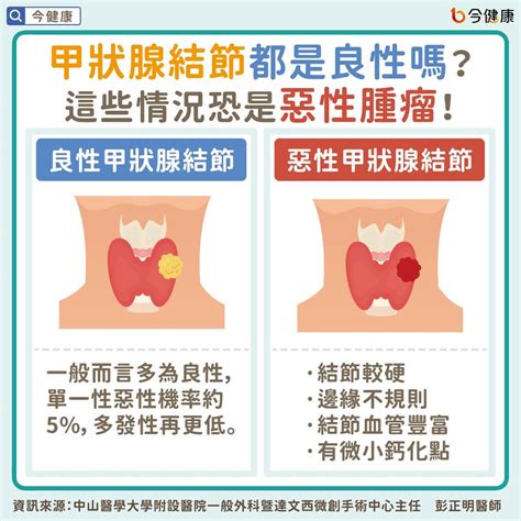 甲狀腺結節都是良性嗎？醫：「4情況」及早治療避免惡化 中天新聞網