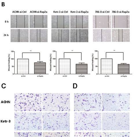 Effects Of Rap A Knockdown On Invasion And Migration In Rcc Cells A