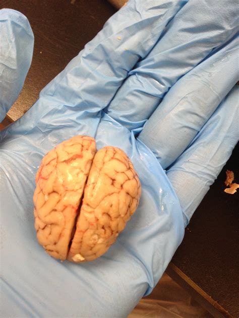 Label The Parts Of The Brain And Spinal Cord Fetal Pig At Richard