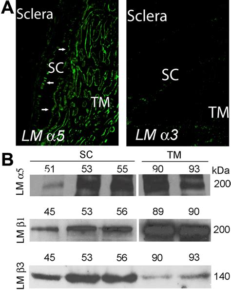 Laminins And In Human Conventional Outflow Pathway And