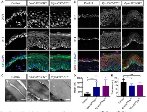 Figure From Vps B And Vipar Are Essential For Epidermal Lamellar