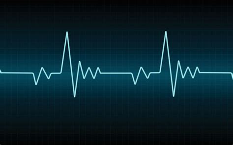 Définition Électrocardiogramme ECG Futura Santé