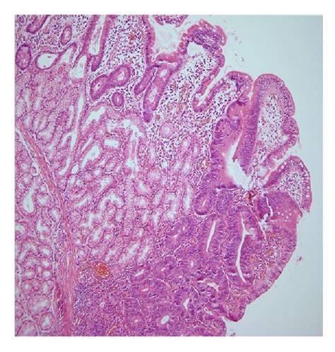 A Histological Examination Of Lesions Showed Structures Of The