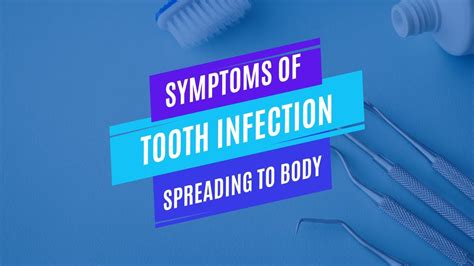 Most Common Symptoms Of Tooth Infection Spreading To Body Youtube