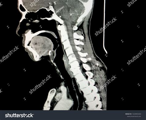 Sagittal Plain Transverse Cut Ct Scan Foto Stock 1020893440 Shutterstock