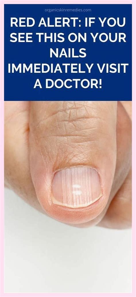 7 Common Nail Conditions Linked To Serious Diseases That You Shouldn’t Ignore In 2024 Nail