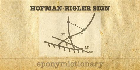 Hoffman Rigler Sign Litfl Medical Eponym Library