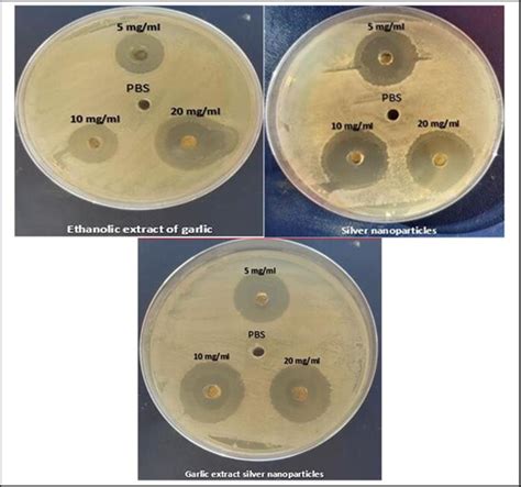 Antibacterial Activity Of Biosynthesized Agnps And Garlic Extract