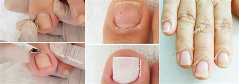 Como Tirar Cuticula Perfeita Descubra O Segredo Das Grandes Manicures