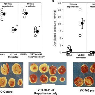 Administration Of VX 765 And A P2Y12 Receptor Antagonist At The Onset