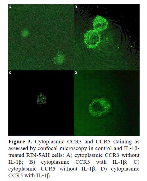 Localization And Expression Of Ccr3 And Ccr5 By Interleukin 1Ã