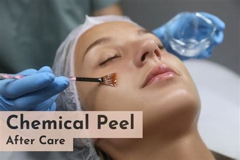 Chemical Peel After Care 6 Tips For Better Results Skinqure